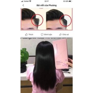 Kem ép size Nam Hoa Anh Đào